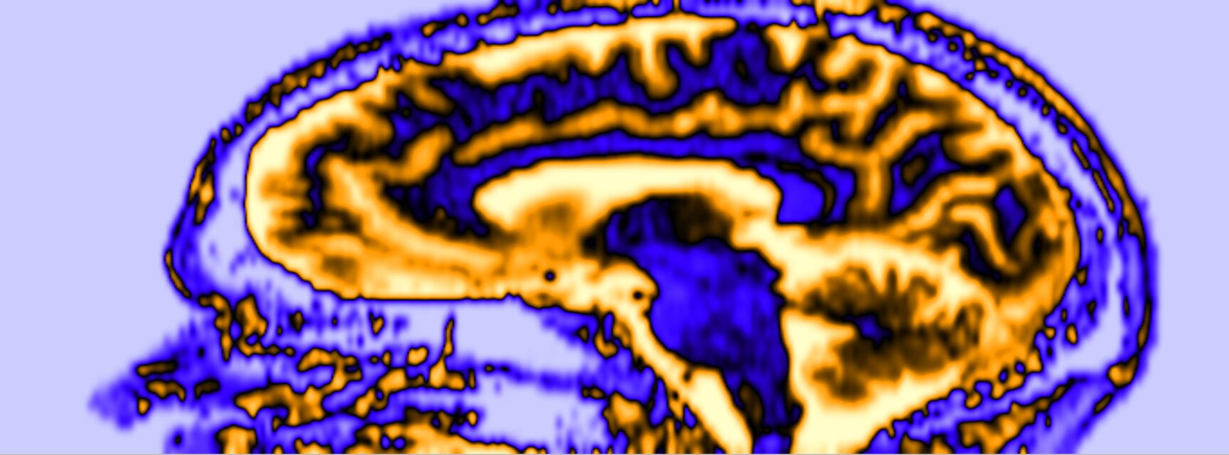 Multimodal Imaging Physics