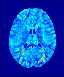 Parameter Correlation Atlases