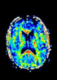 Myelin Mapping